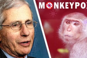 Fauci Monkeypox